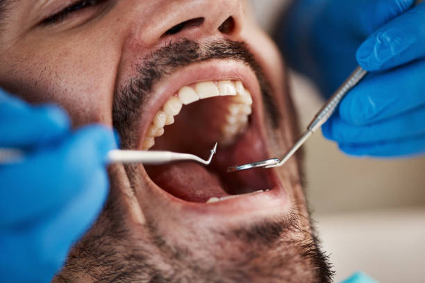 Dental Bonding in Texanna, OK
